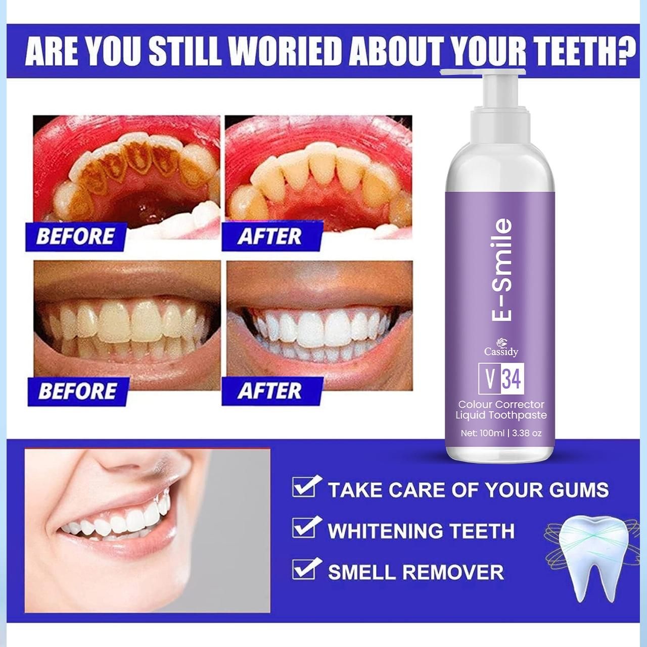 E-Smile Colour Corrector Liquid Toothpaste 200ml Pack of 2