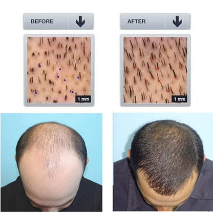 TryOnes Hair Growth Spray  30ml (Pack of 2)