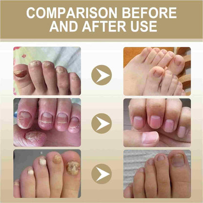 Zidella Herbal Nail Nourishing Essence ? 30ml (Pack of 2)