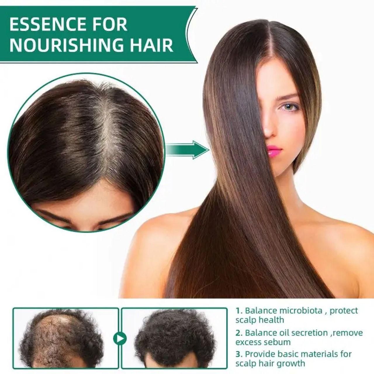 Wets & Months Hair Growth Essence Anti Hair Loss 120ml Pack of 2