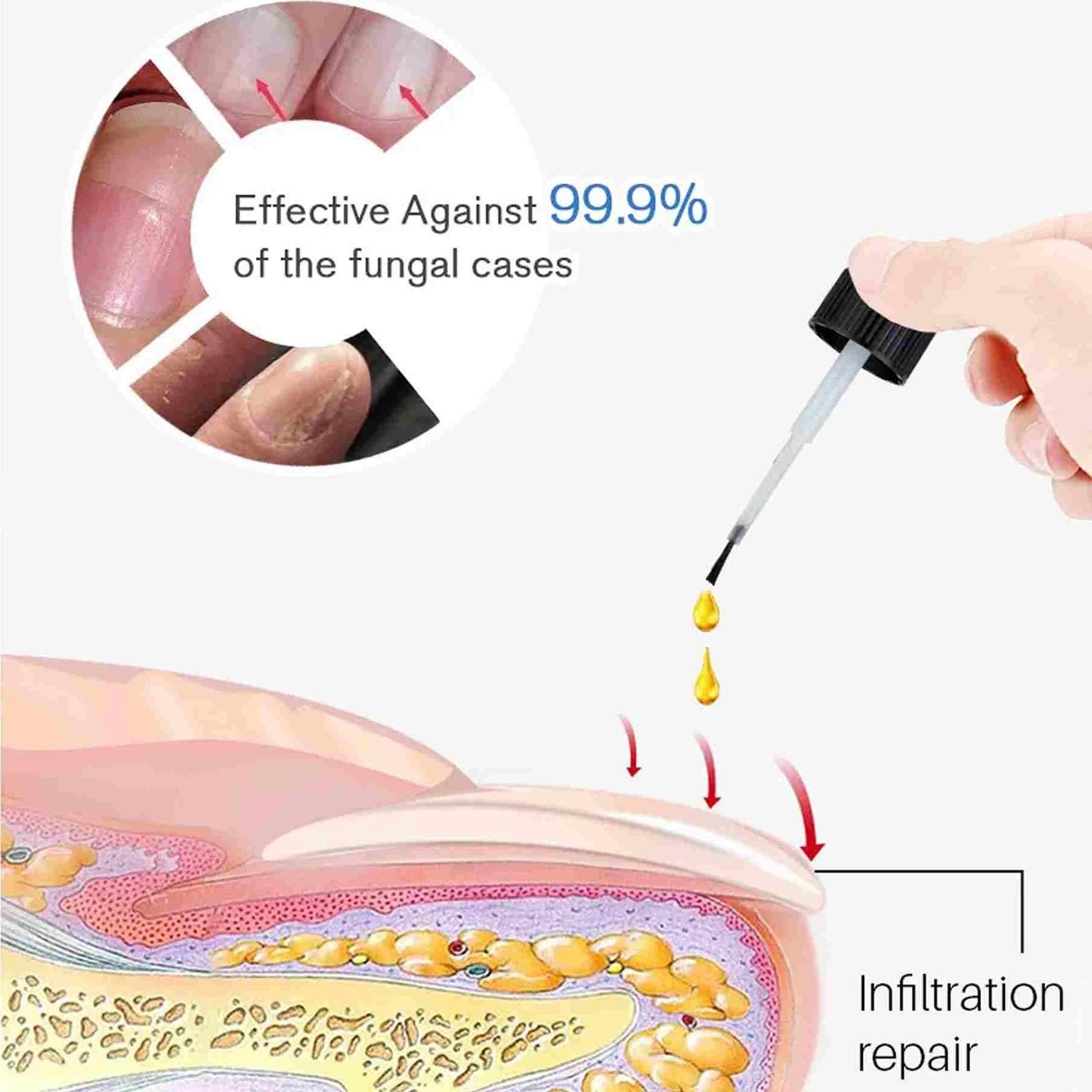 Zidella Advanced Nail Repair Essence for Discoloration & Damage ? 30ml (Pack of 2)