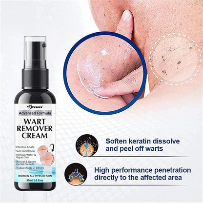 Fezora  Wart Remover Ointment, Wart Remover Cream (50ml) (Pack of 2)