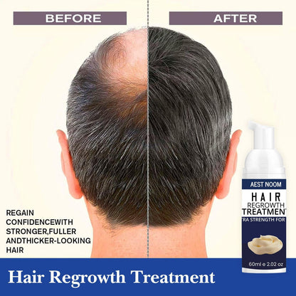 AEST NOOM Hair Regrowth Treatment Extra Strength Formula 60ml